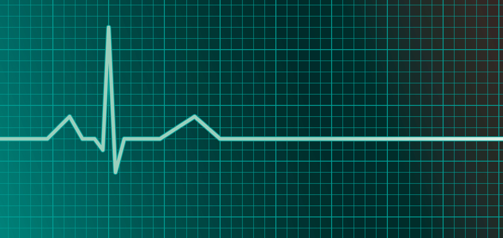 Кардиограмма остановки сердца картинки