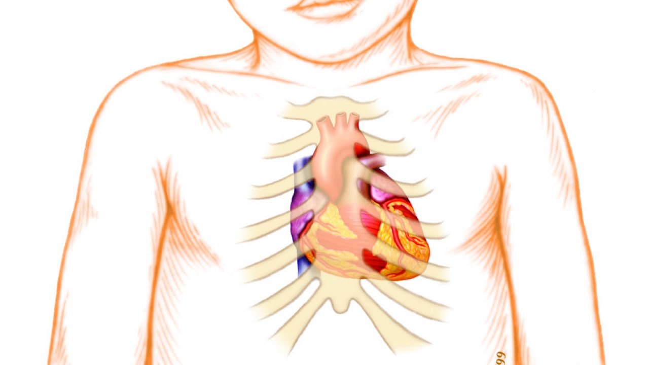 Learning The Language Of Pediatric Heart Sounds American Nurse