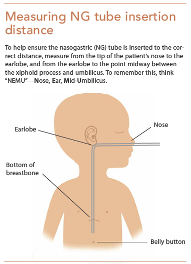 Verifying NG feeding tube placement in pediatric patients - American Nurse