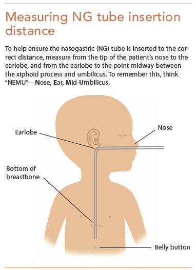 Verifying Ng Feeding Tube Placement In Pediatric Patients American Nurse