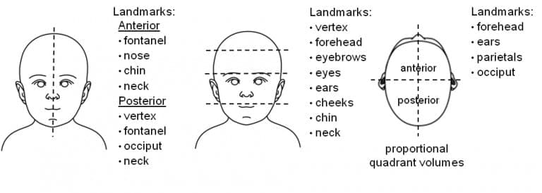 Newborn positioning, plagiocephaly screening, and parent education