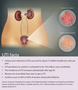 cystitis prevention