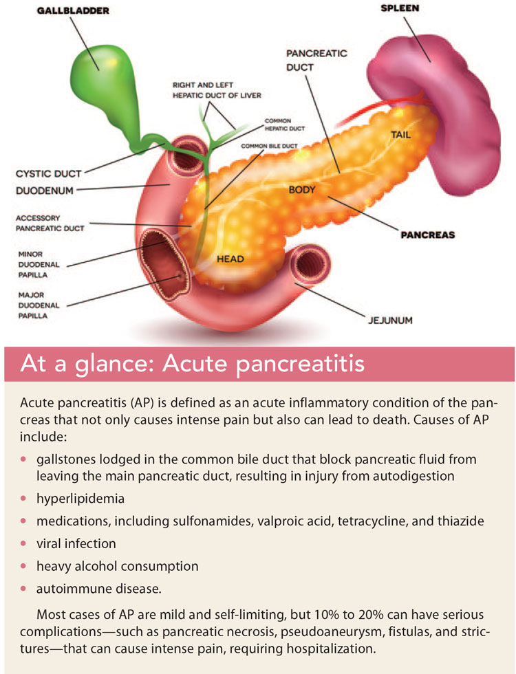 Total pancreatectomy with islet cell autologous transplantation: A ...