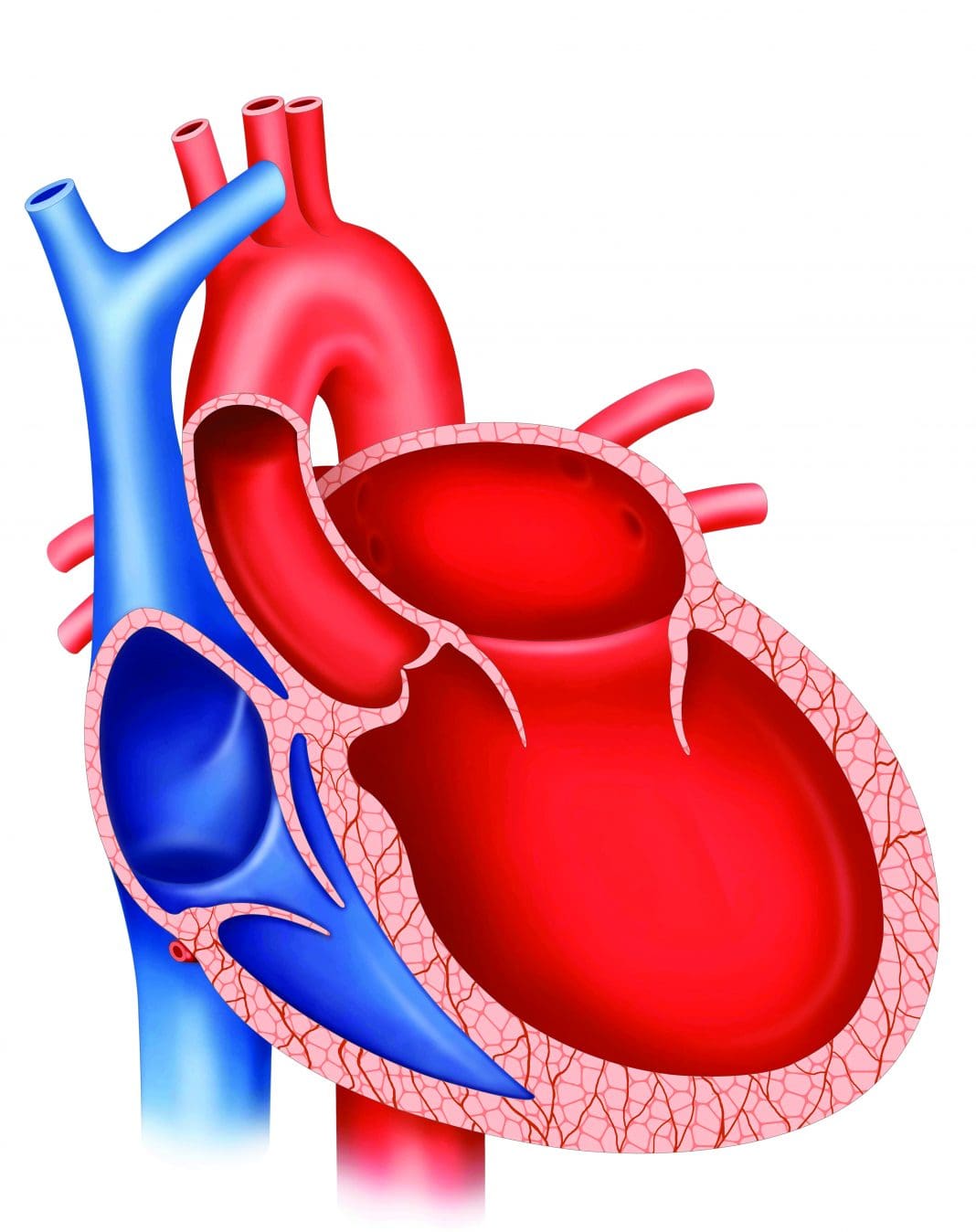 ACM (Arrhythmogenic cardiomyopathy): an educational overview