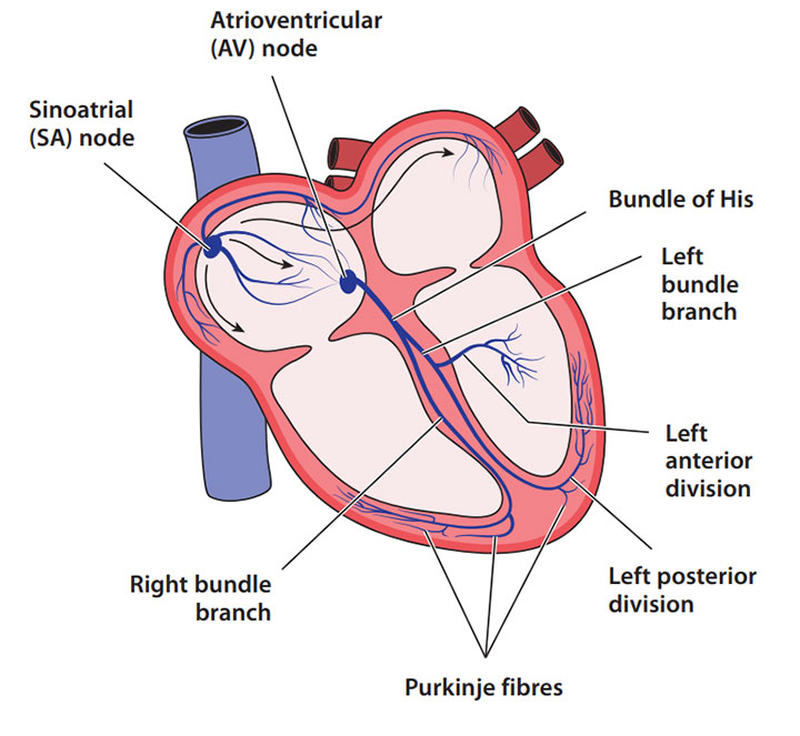 Bundle pacing: an alternative for those who aren't responding to treatment